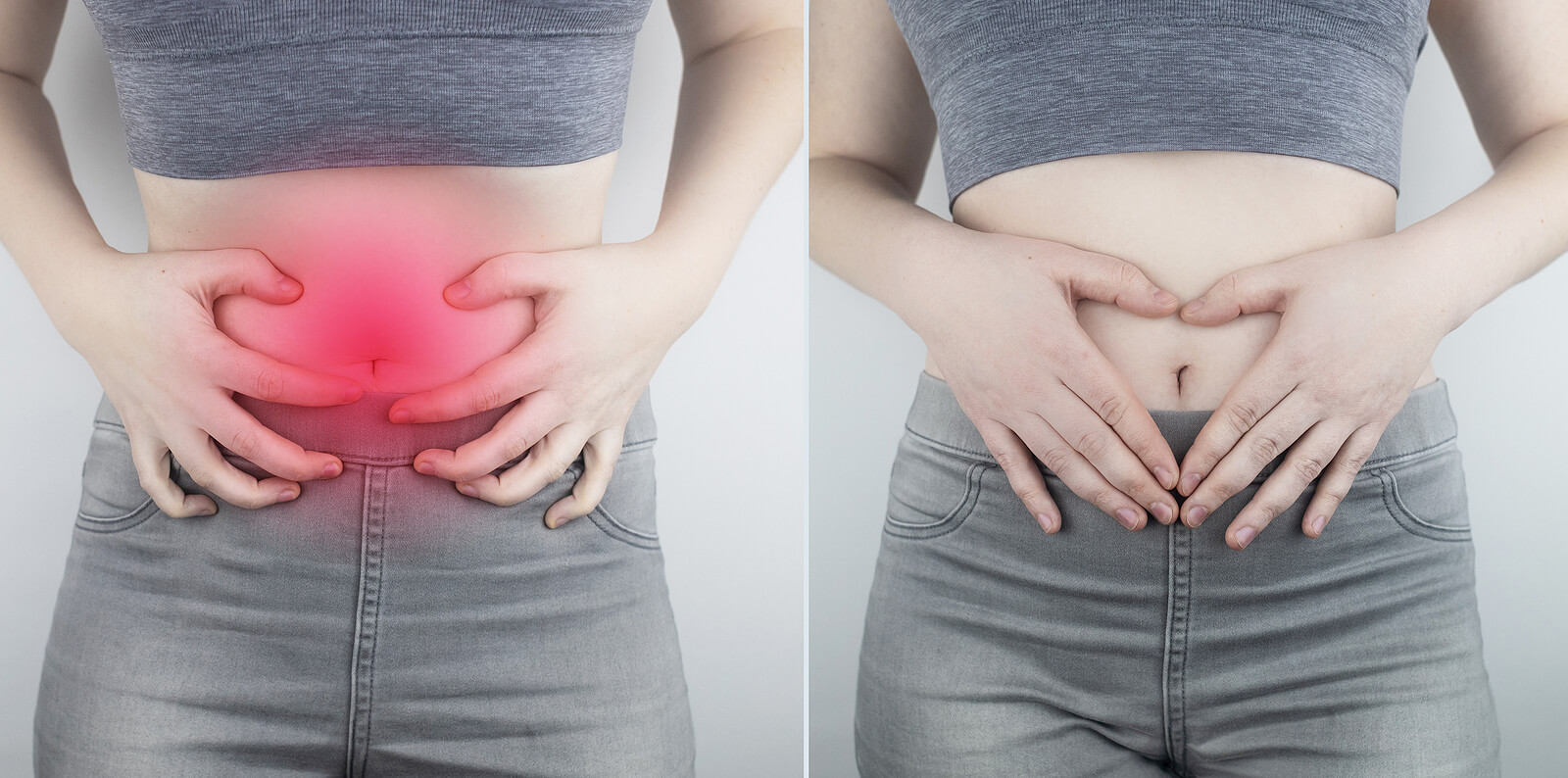 Before And After Abdominal Pain. On The Left Is A Photo Of How T
