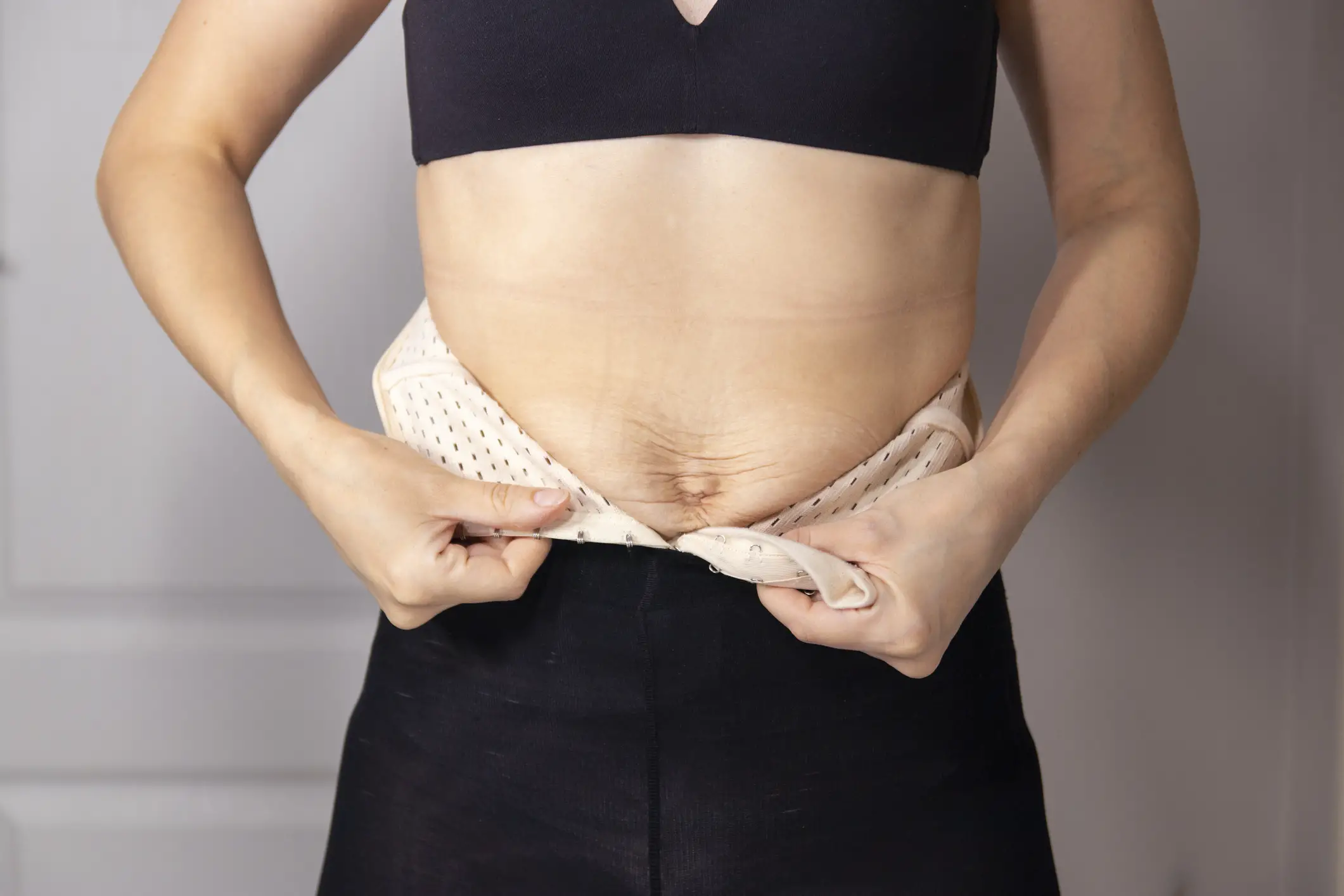 Diastasis recti after child birth. woman wearing a corset to support the abdomen during diastasis